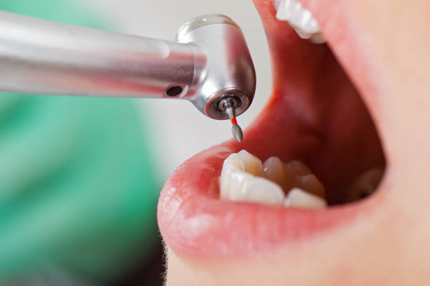 Best Emergency Dental Care for Broken or Chipped Teeth in Alderwood Manor, WA